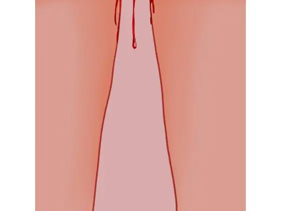 生理痛に呻く真園あきら